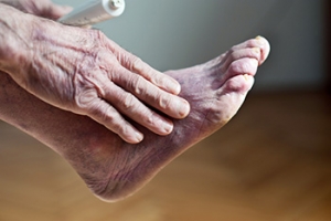 Cold Feet May Indicate Poor Circulation