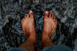 What Can Be Done About Hammertoe Deformities