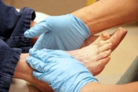 Nurturing Diabetic Feet with Knowledge and Caution