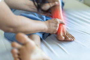 Recognizing and Managing Tarsal Tunnel Syndrome