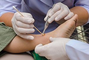 What are Foot Ulcers and What They Mean for Diabetics